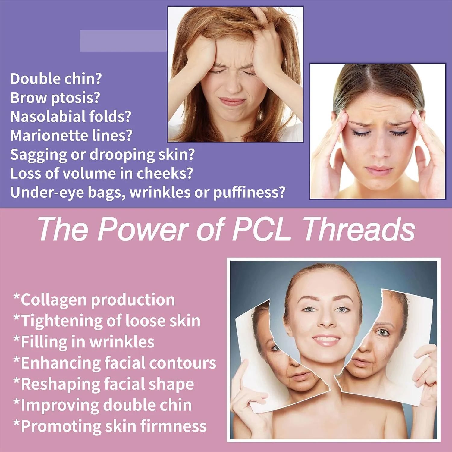 elves PCL Threads for Face Pcl Screw Thread Lift 30G25mm Mono Screw Type Face Lifting 20Pcs Facial Thread Smoothing Wrinkles with Sharp Tip